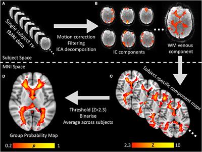 An Experimental Investigation of White Matter Venous Hemodynamics: Basic Physiology and Disruption in Neuroinflammatory Disease